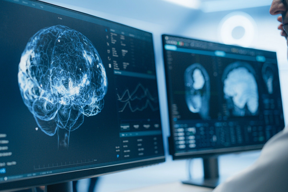 Şizofreniyadan qoruyan beyin hüceyrələri yaradılıb